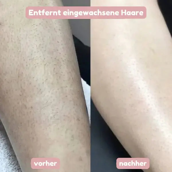 Éclat de Soie™ | Rasoir 2-en-1 pour femme pour une peau douce et soignée