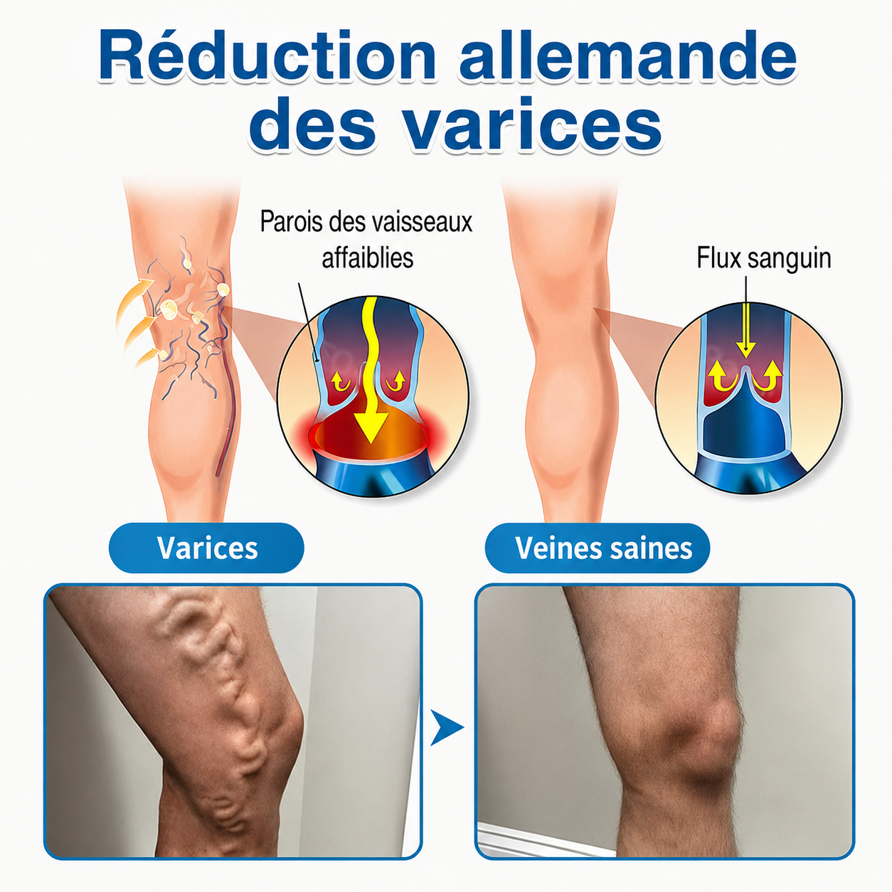 GFOUK® VeinRepair | Rouleau de Patchs à Micro-Aiguilles