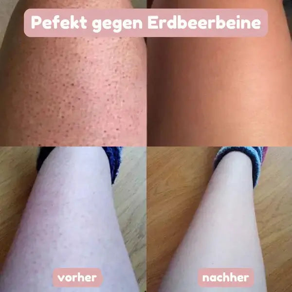 Éclat de Soie™ | Rasoir 2-en-1 pour femme pour une peau douce et soignée