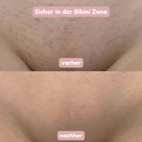 Éclat de Soie™ | Rasoir 2-en-1 pour femme pour une peau douce et soignée