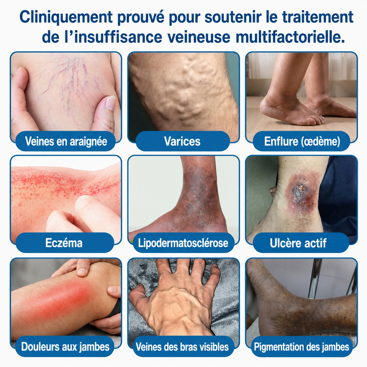 GFOUK® VeinRepair | Rouleau de Patchs à Micro-Aiguilles