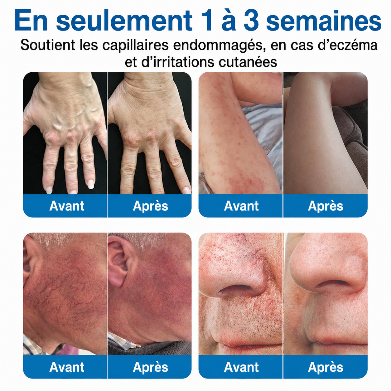 GFOUK® VeinRepair | Rouleau de Patchs à Micro-Aiguilles