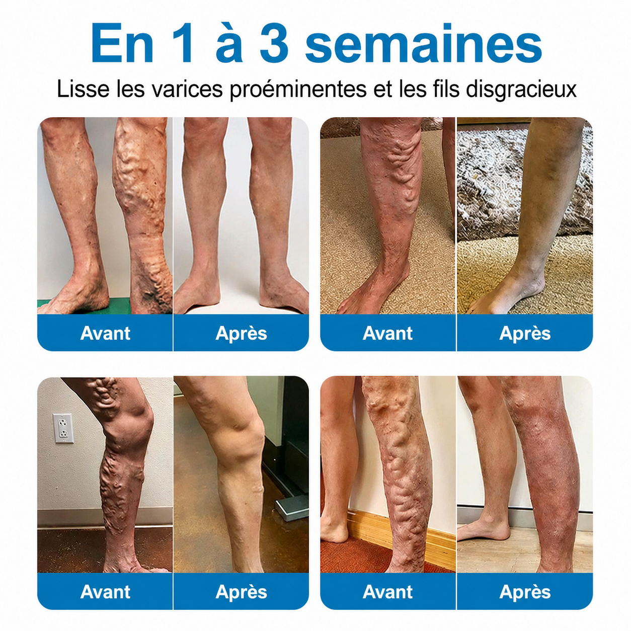 GFOUK® VeinRepair | Rouleau de Patchs à Micro-Aiguilles