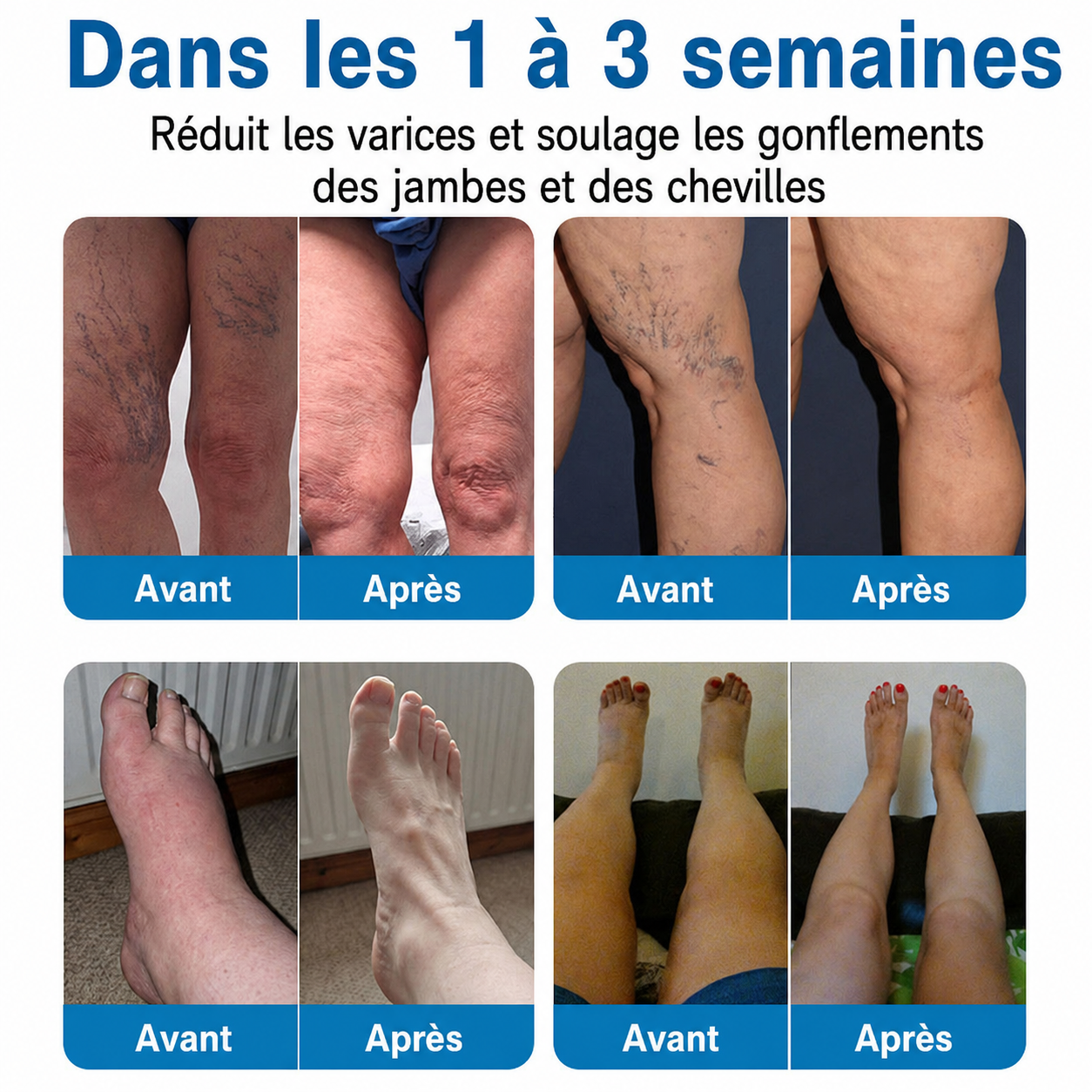 GFOUK® VeinRepair | Rouleau de Patchs à Micro-Aiguilles