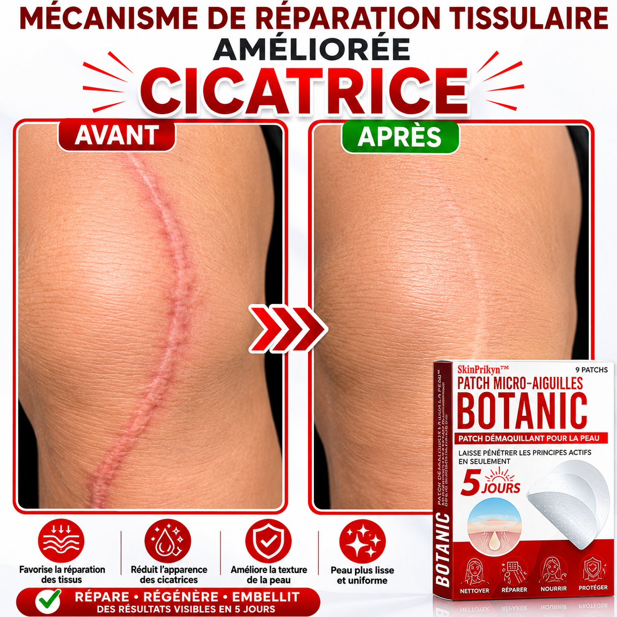 SkinPrikyn™ | Patch Botanique à Micro-Aiguilles pour une Peau Nette et Uniforme