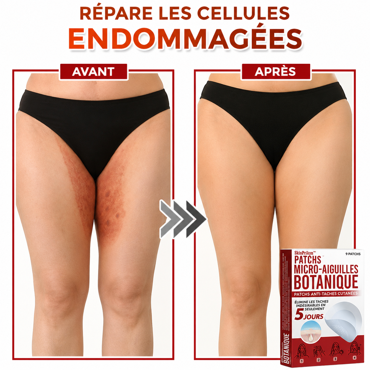SkinPrikyn™ | Patch Botanique à Micro-Aiguilles pour une Peau Nette et Uniforme