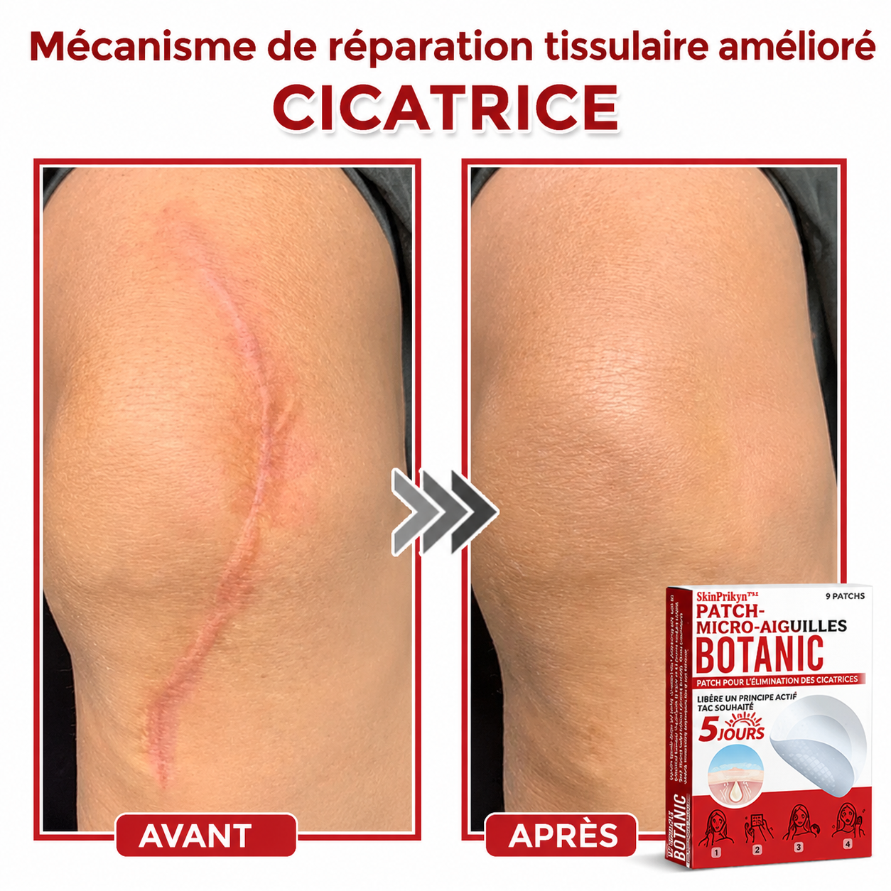 SkinPrikyn™ | Patch Botanique à Micro-Aiguilles pour une Peau Nette et Uniforme