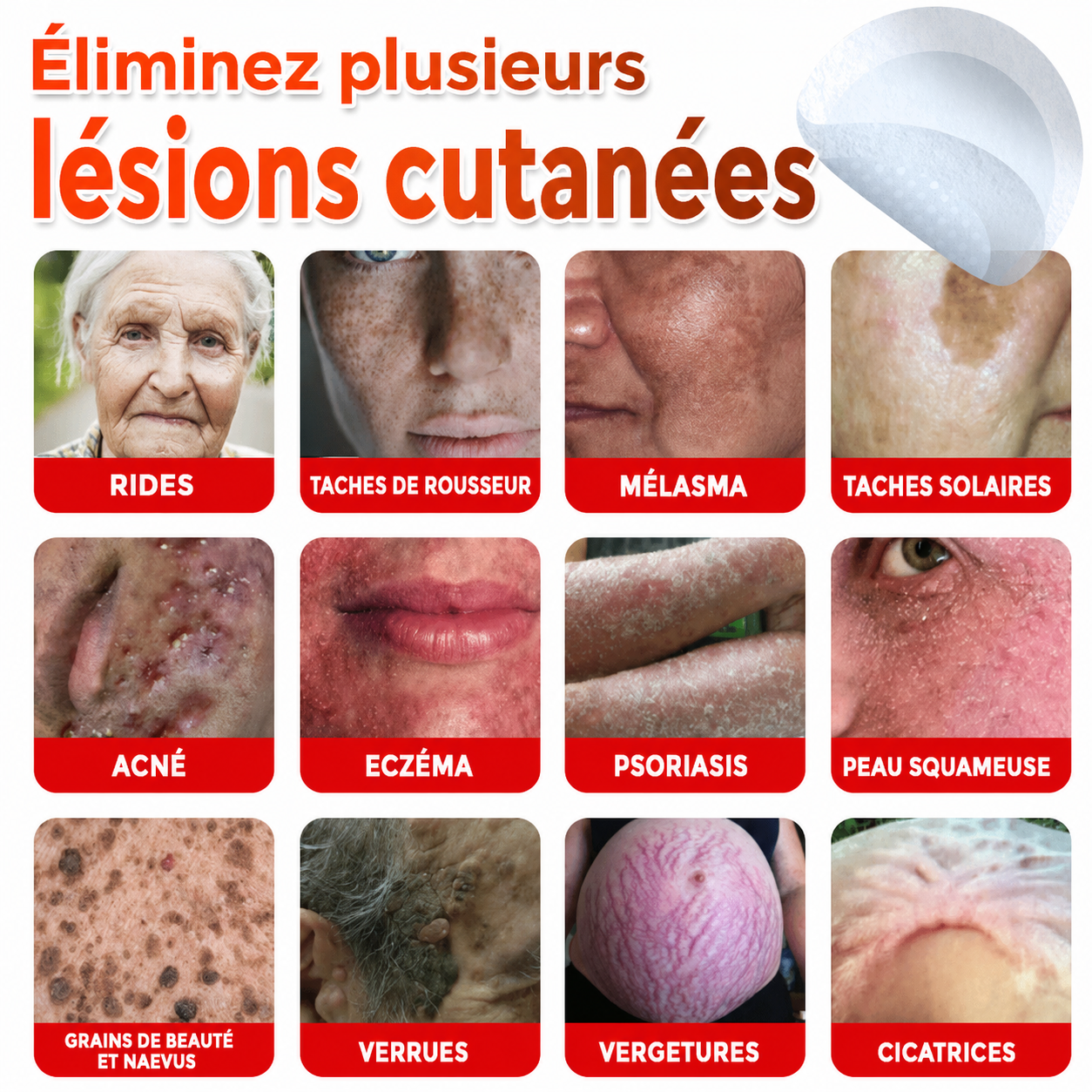 SkinPrikyn™ | Patch Botanique à Micro-Aiguilles pour une Peau Nette et Uniforme